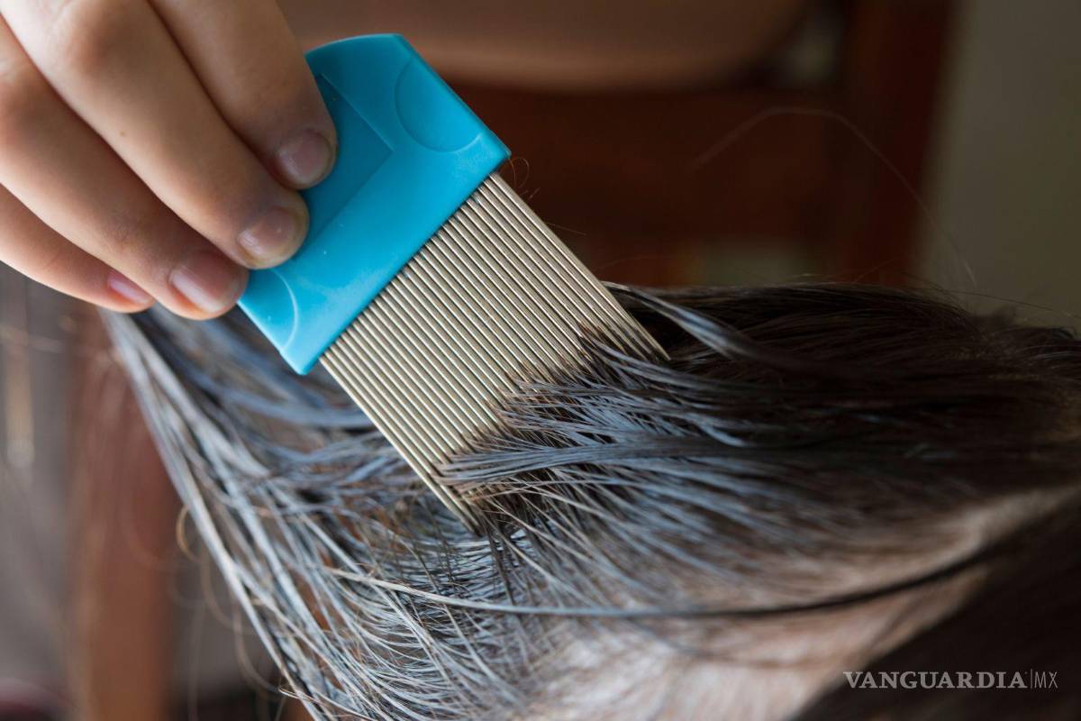 ¿Temporada de piojos en Saltillo? No tienes que raparte, esta es la mejor forma de tratarlos