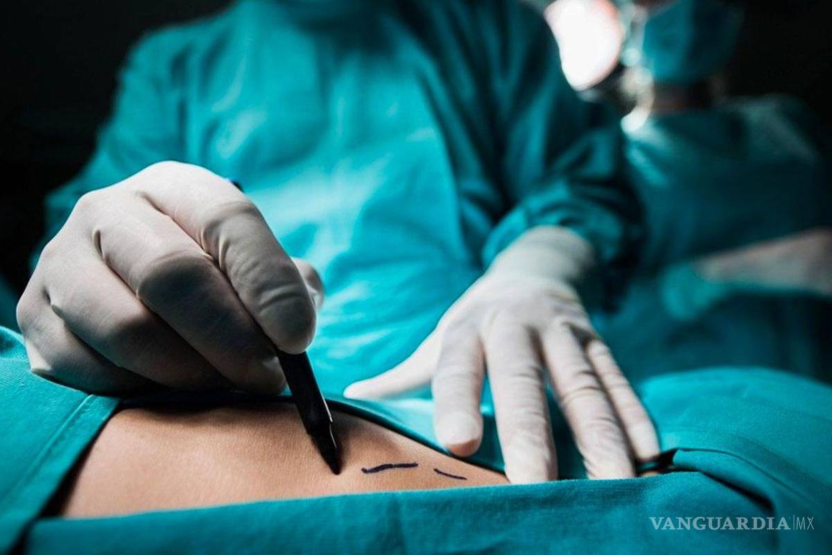 Solo 15 médicos plásticos certificados operan en 22 hospitales de la Región Laguna
