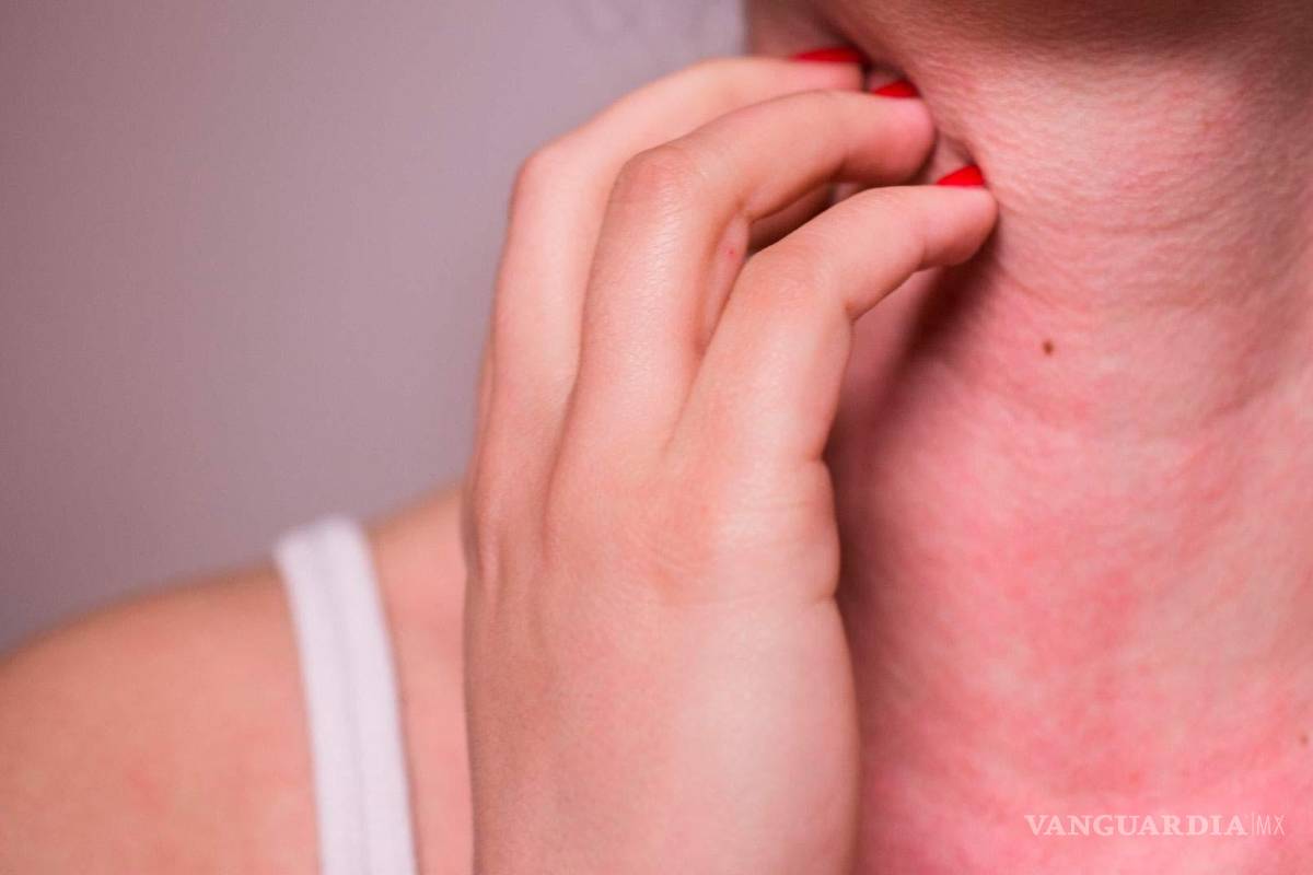 Aumentan las posibilidades de padecer alergias, advierten