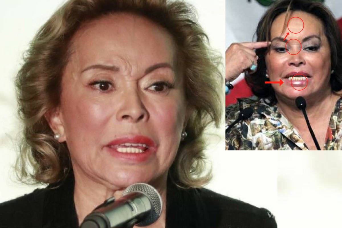 Elba Esther Gordillo, estrenó rostro al estilo Hollywood y ¿sólo estuvo 4 días en prisión?