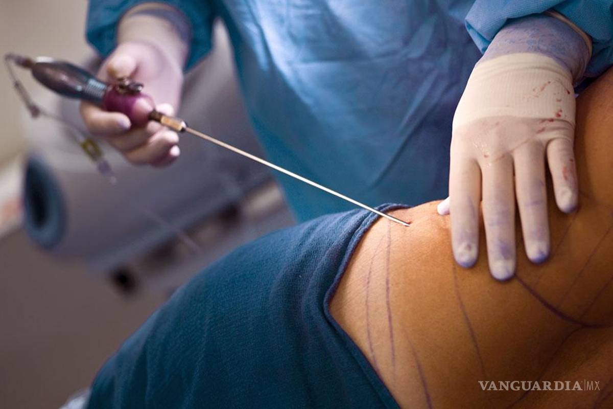 Revisarán documentos en clínicas de belleza de Acuña y Piedras Negras tras fallecimiento