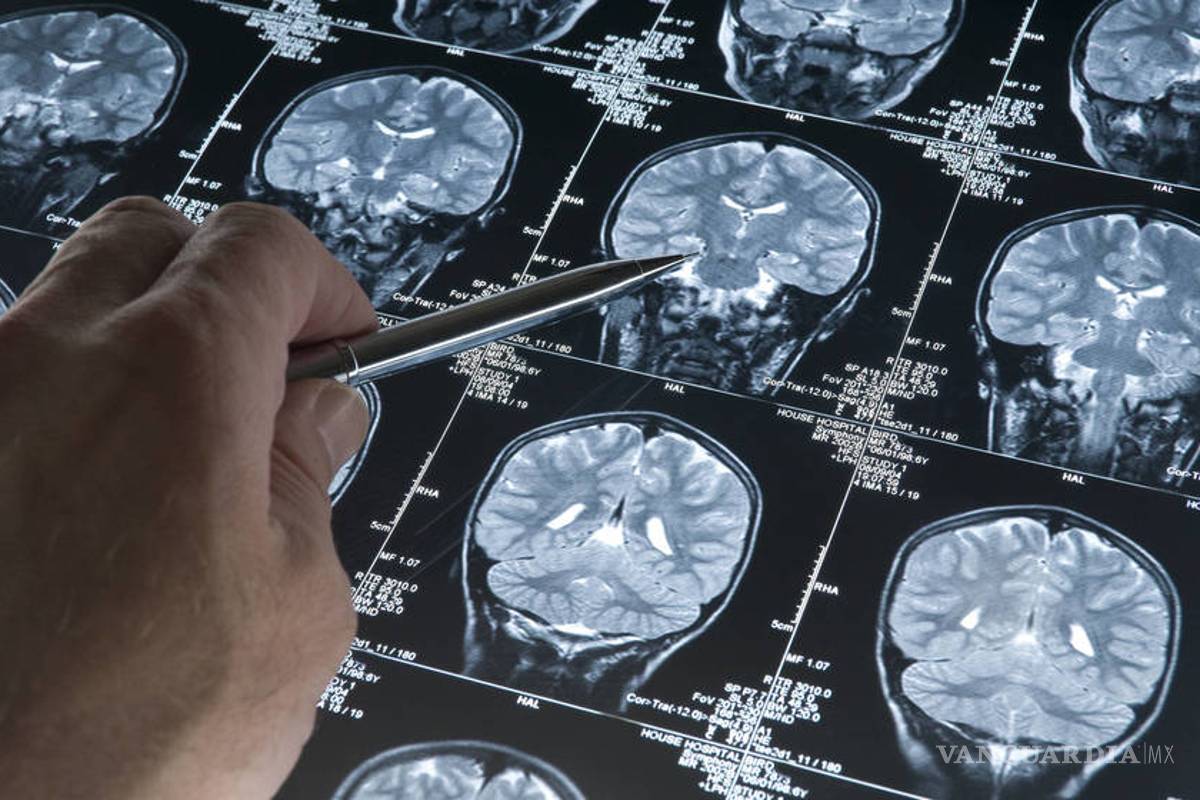 Alzheimer podría ser curado, científicos chilenos descubren cómo detener su progreso