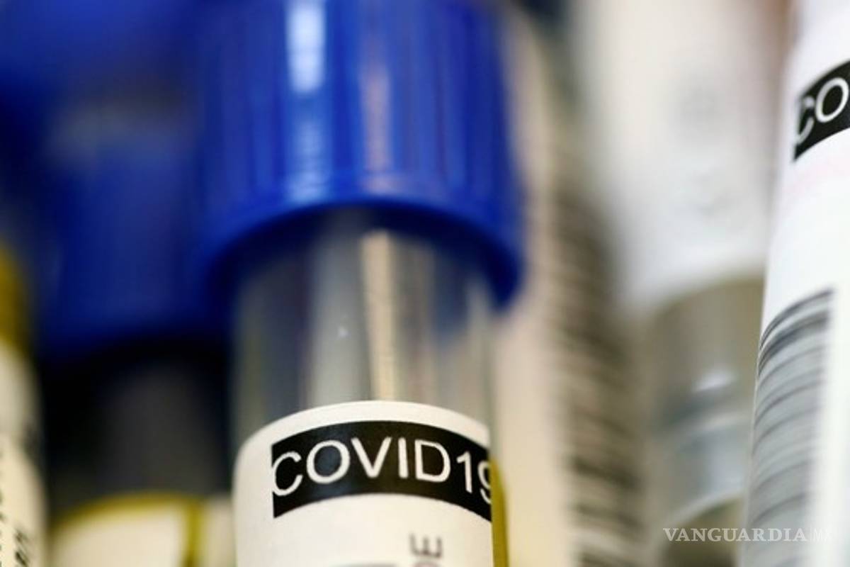 Hasta 15 días tardan para entregar resultados de pruebas COVID-19 en Coahuila