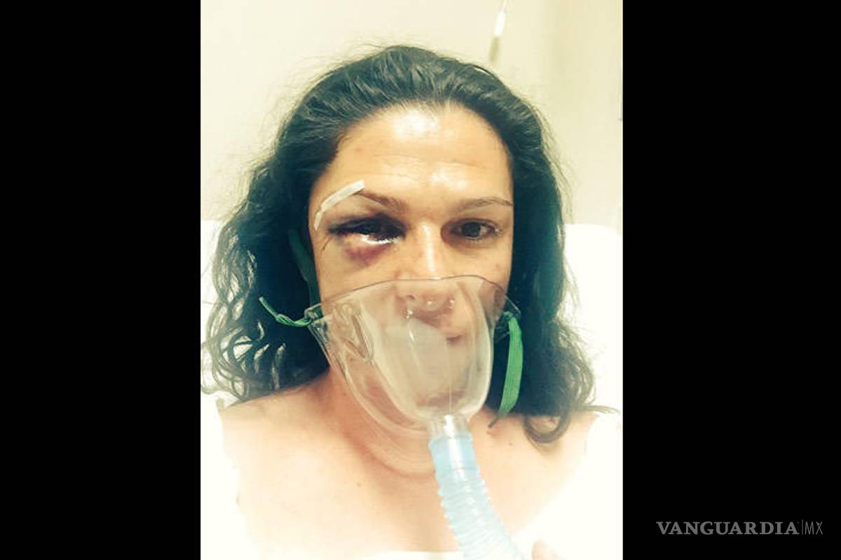 Ana Guevara fue agredida 'por ser mujer en motocicleta'