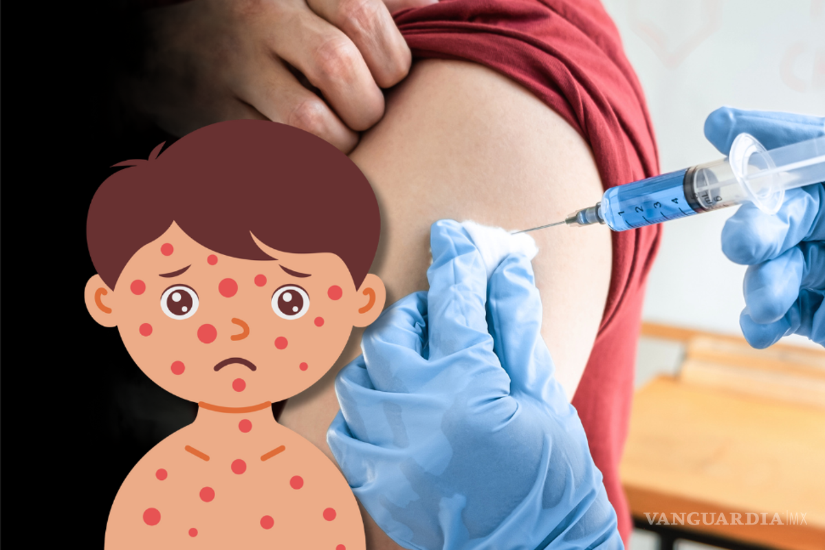 Aumentan casos de sarampión en México: quiénes deben de aplicarse la vacuna y a dónde acudir