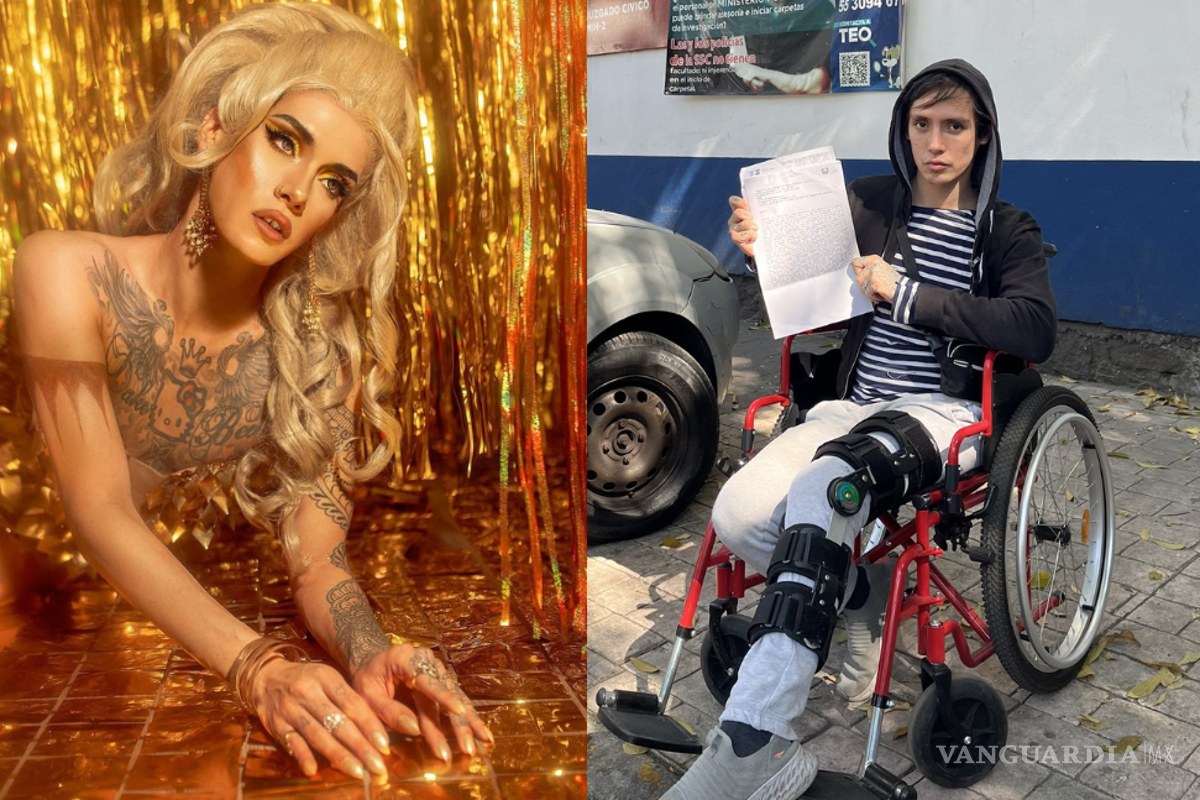 Drag queen Genn Taft denuncia accidente en Uber Moto que le puede dejar sin caminar bien