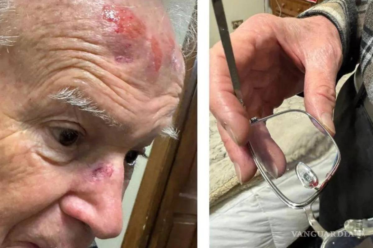 Saltillo: a pesar de resentir los efectos de su caída, el obispo Raúl Vera se niega a recibir atención médica