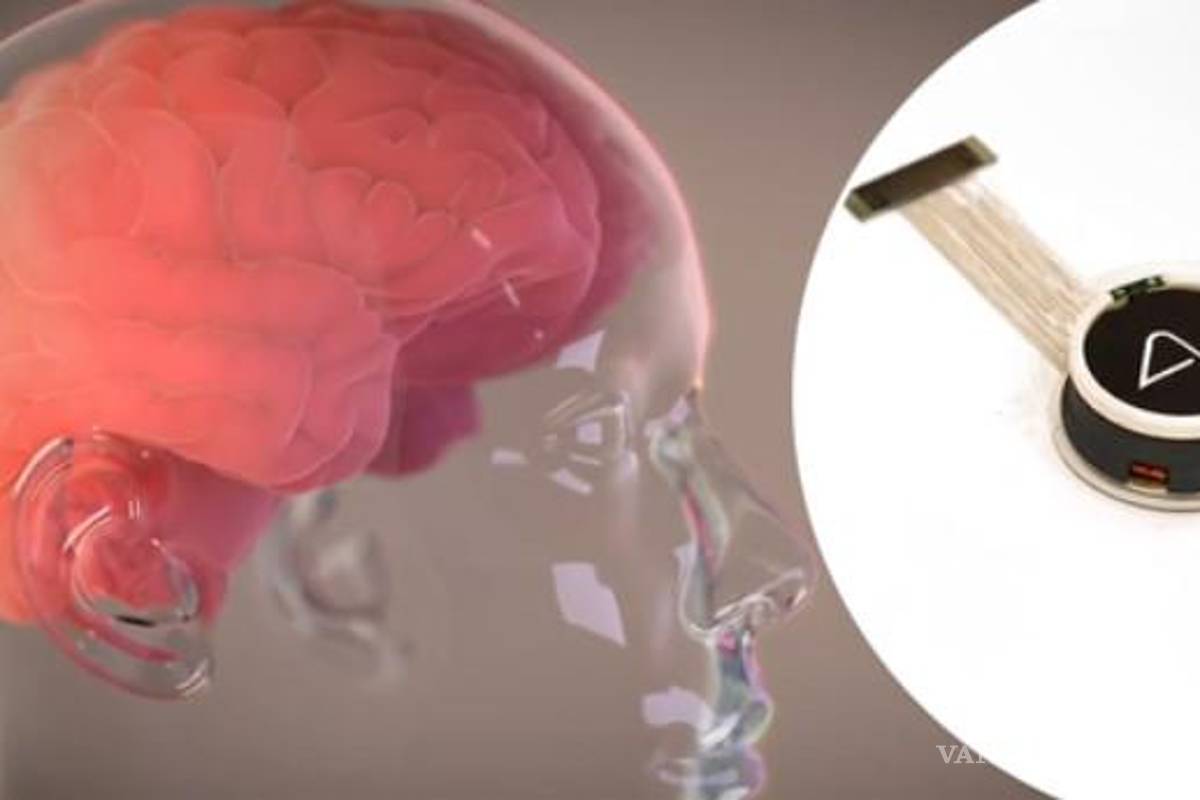 Estas son las teorías de conspiración sobre el proyecto de Neuralink de Elon Musk