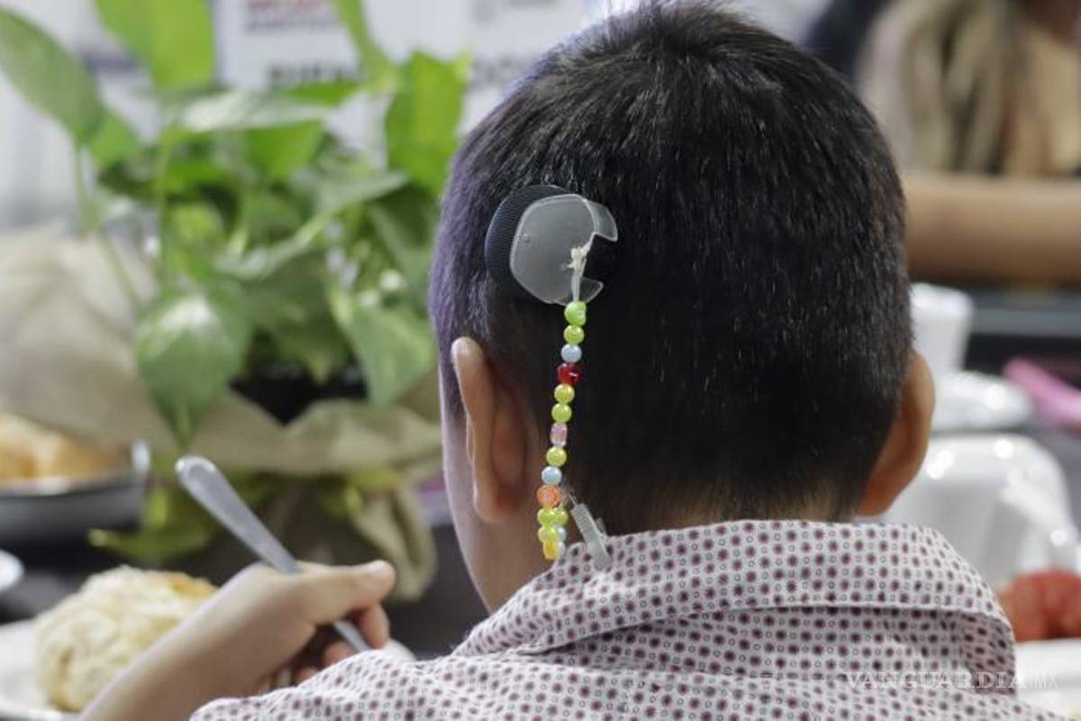 $!Así luce uno de los diferentes tipos de aparatos auditivos entregados: implantes cocleares, implante de conducción ósea y diadema ad care.
