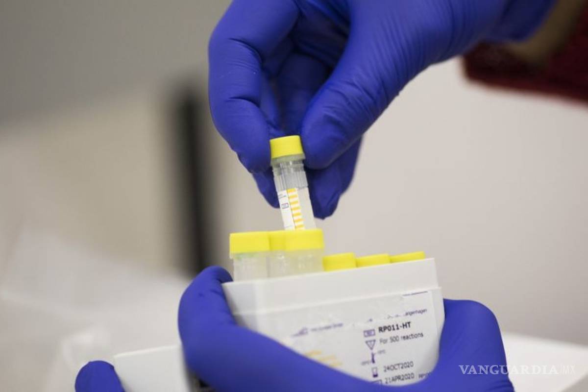 EU da aprobación de emergencia a kit para detectar COVID-19 de empresa china