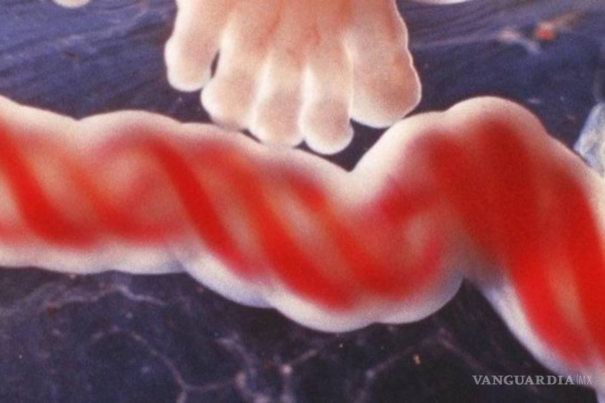 Cordón umbilical y sus células madre podrían ayudar a pacientes con COVID-19: estudio