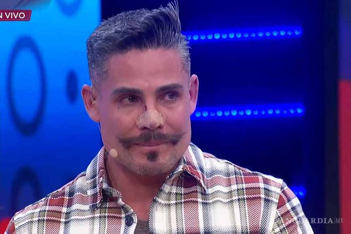 Conductor de 'Enamorándonos podría perder la nariz por una cirugía mal practicada