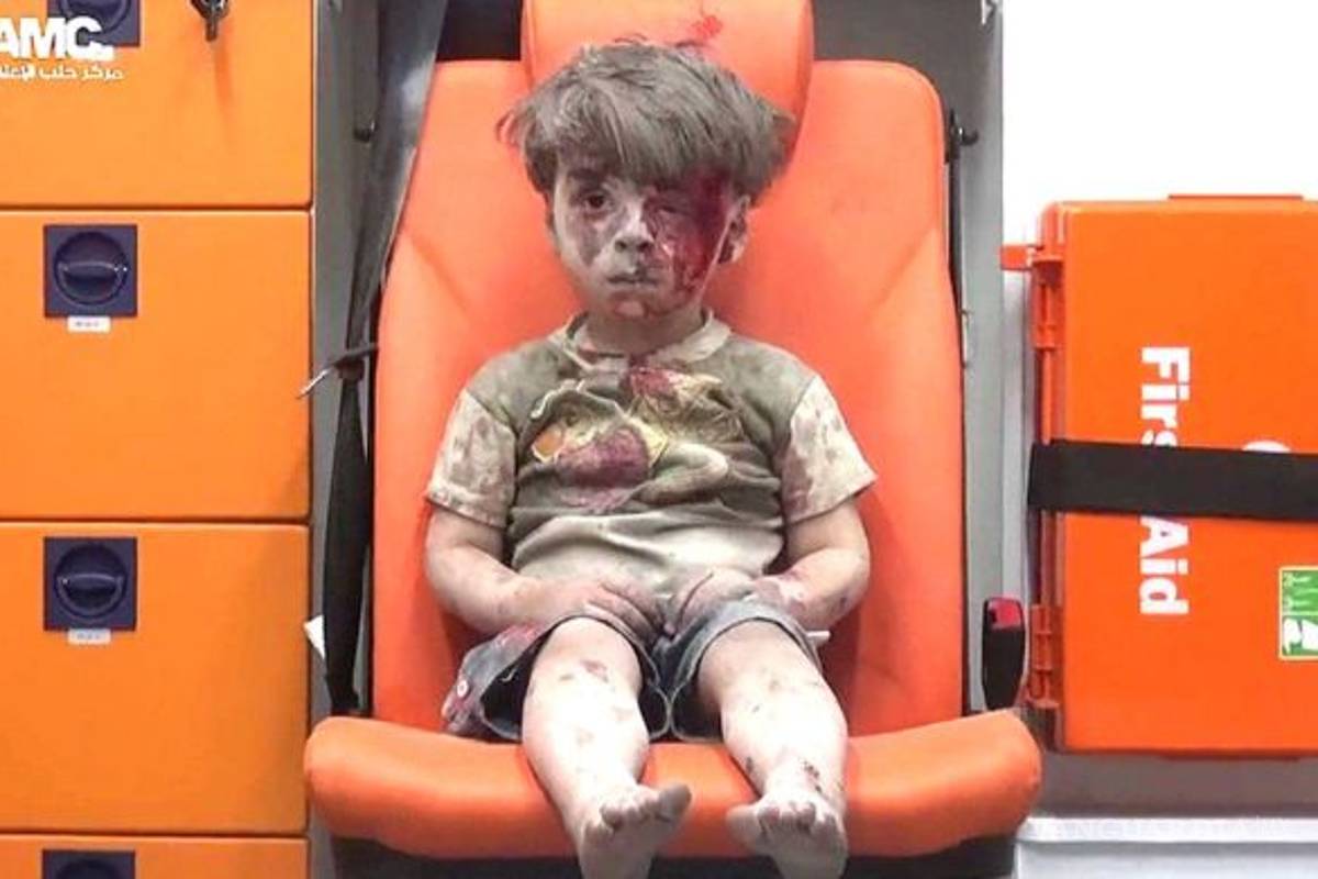 Omran Daqneesh, el verdadero rostro de la guerra en Siria