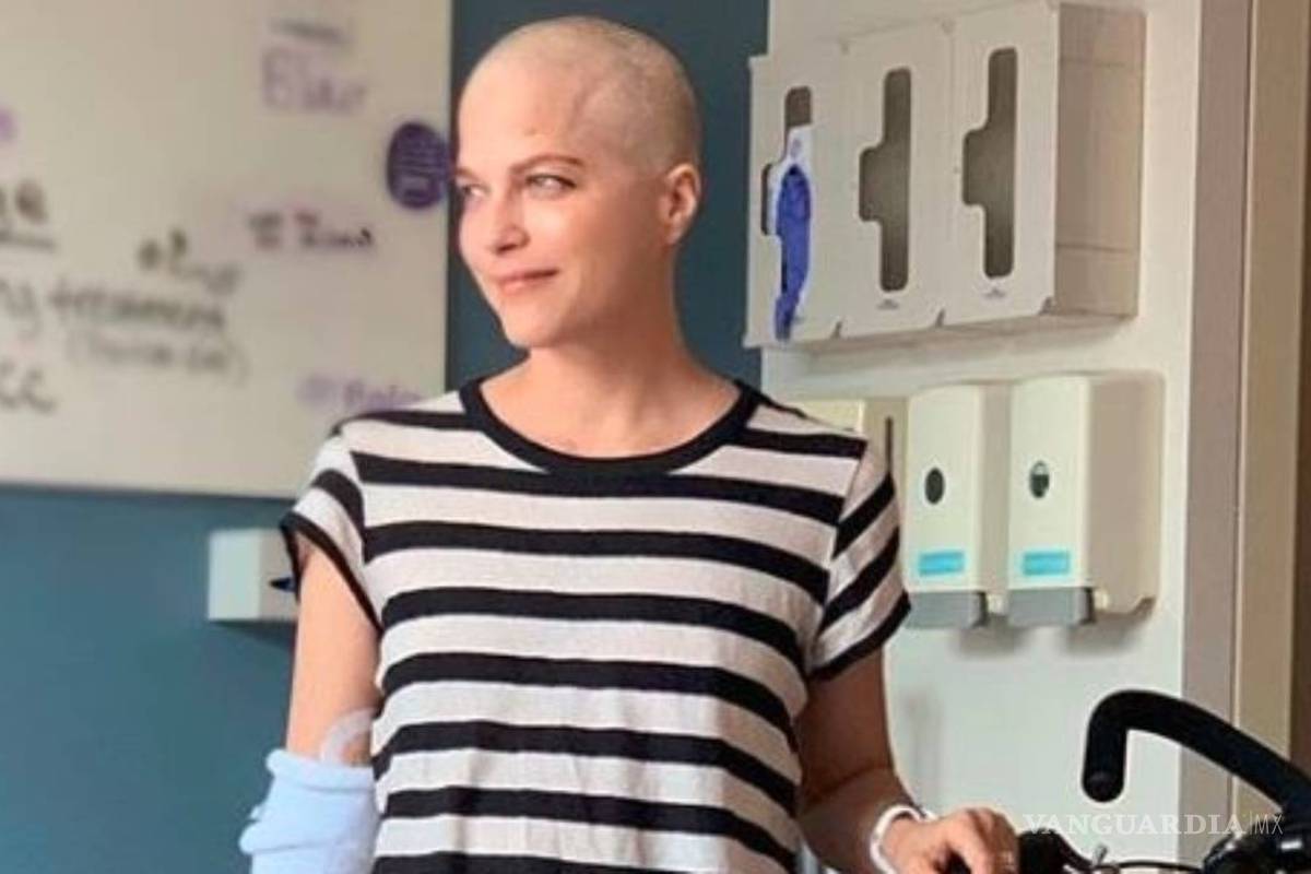 Selma Blair aparece calva para tratamiento por esclerosis múltiple