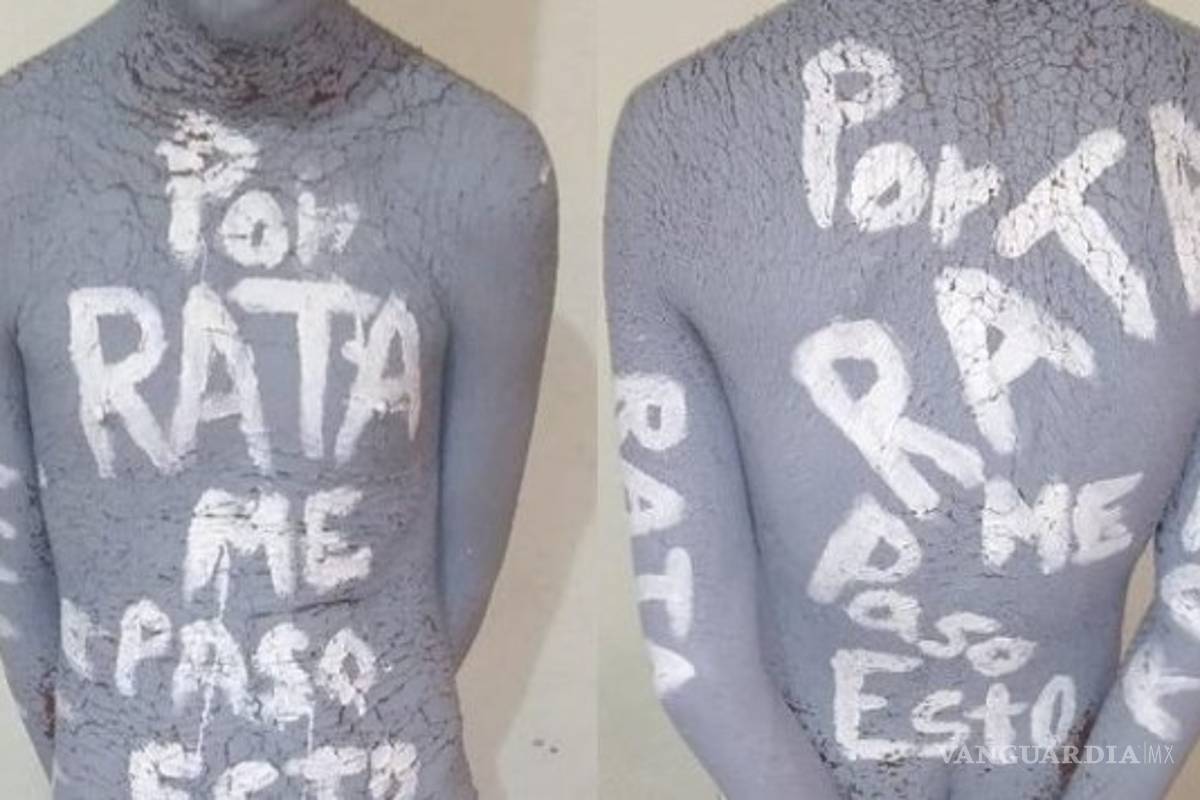 'Esto me pasa por rata'... joven de 15 años es torturado por comando armado y le amputan las dos manos en Veracruz