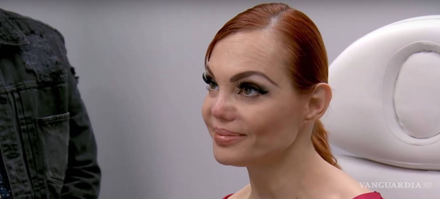 Así reaccionó Carmen Campuzano al saber que su nariz no tiene arreglo