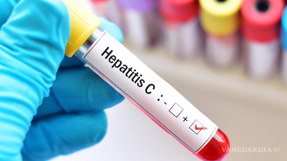 Destaca Coahuila en lucha contra la Hepatitis C