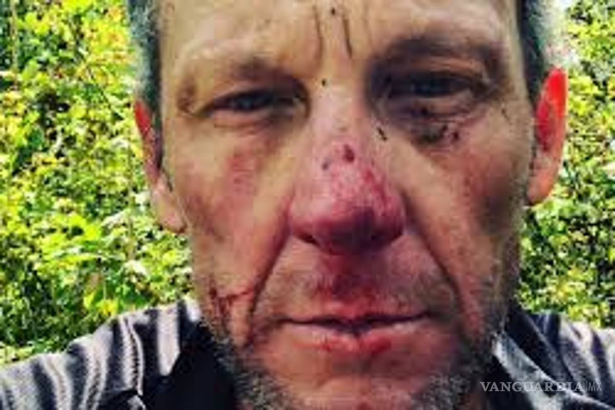 El terrible accidente que sufrió Lance Armstrong