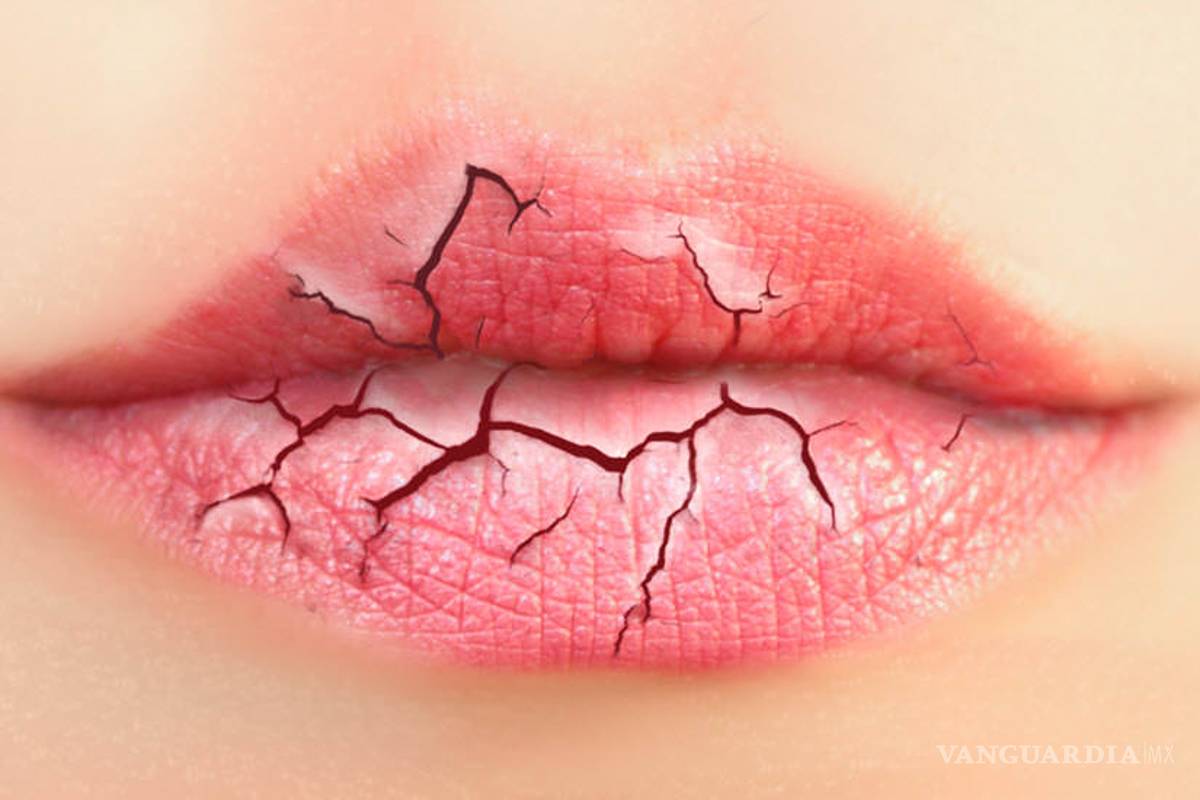 12 razones por las que se resecan tus labios y cómo prevenirlo