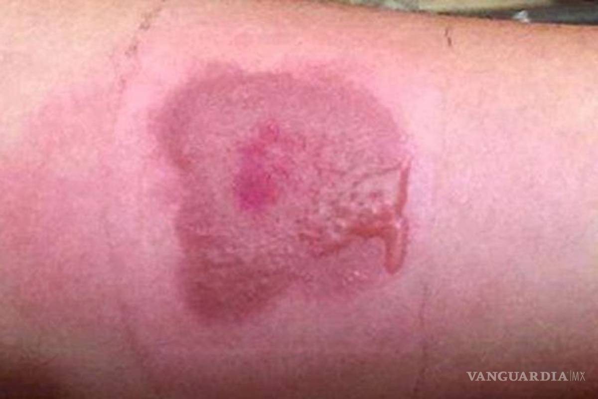 $!Alertan por el peligroso reto viral de la sal y el hielo