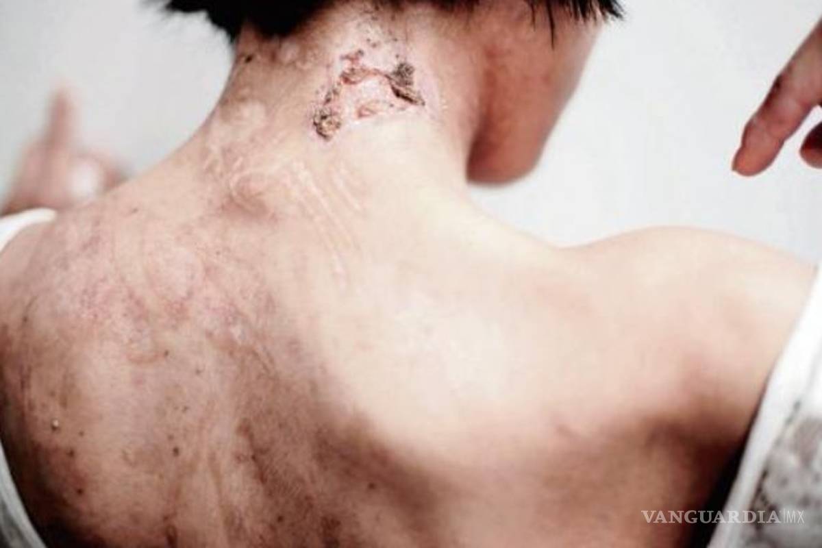 La escalofriante historia de Zunduri, 'la esclava de la tintorería'