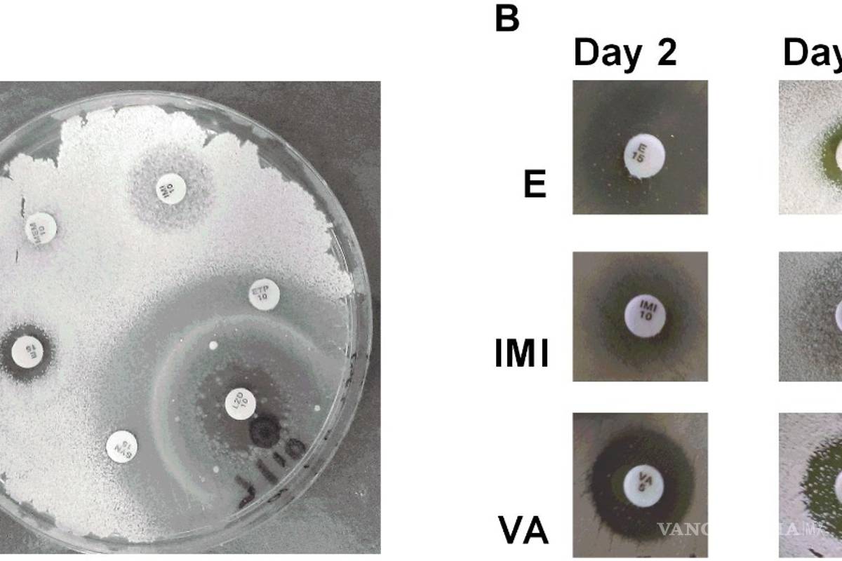 Descubren una bacteria efectiva contra 4 patógenos multirresistentes
