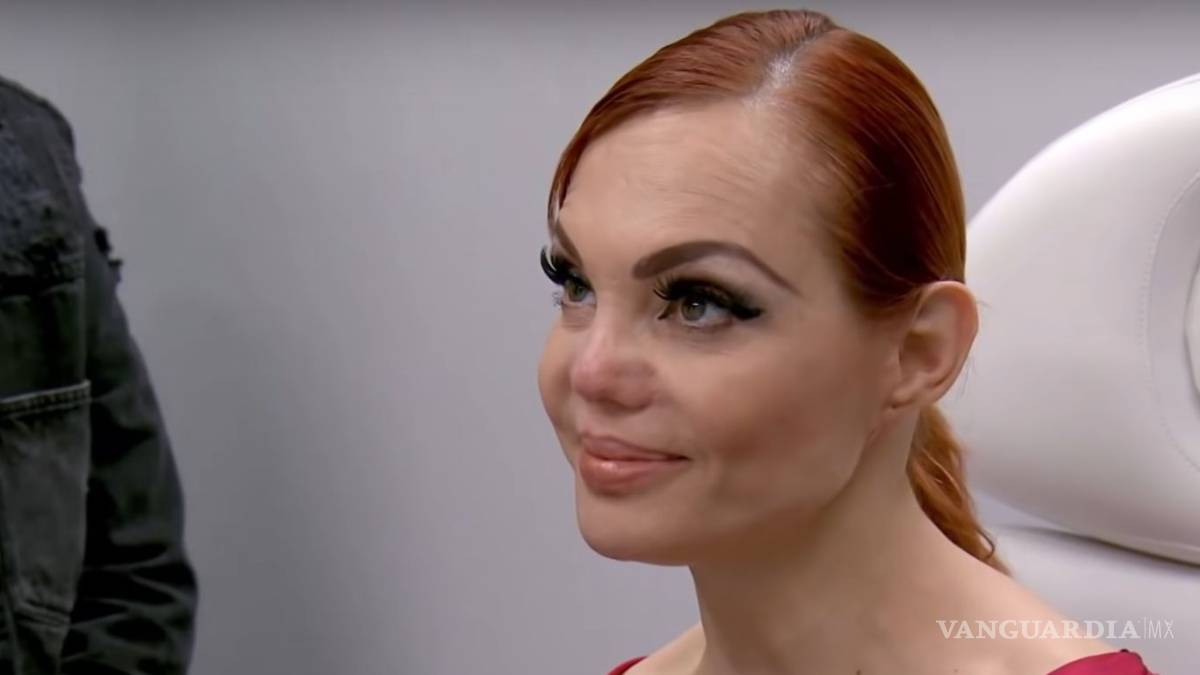 Así reaccionó Carmen Campuzano al saber que su nariz no tiene arreglo