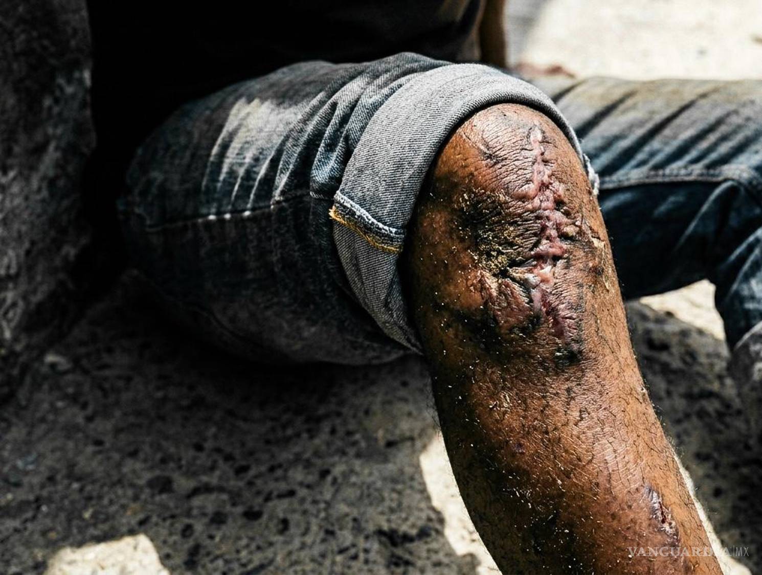 $!Un hombre en la calle muestra signos físicos del desgaste, lleno de heridas y cansancio, por un largo viaje.