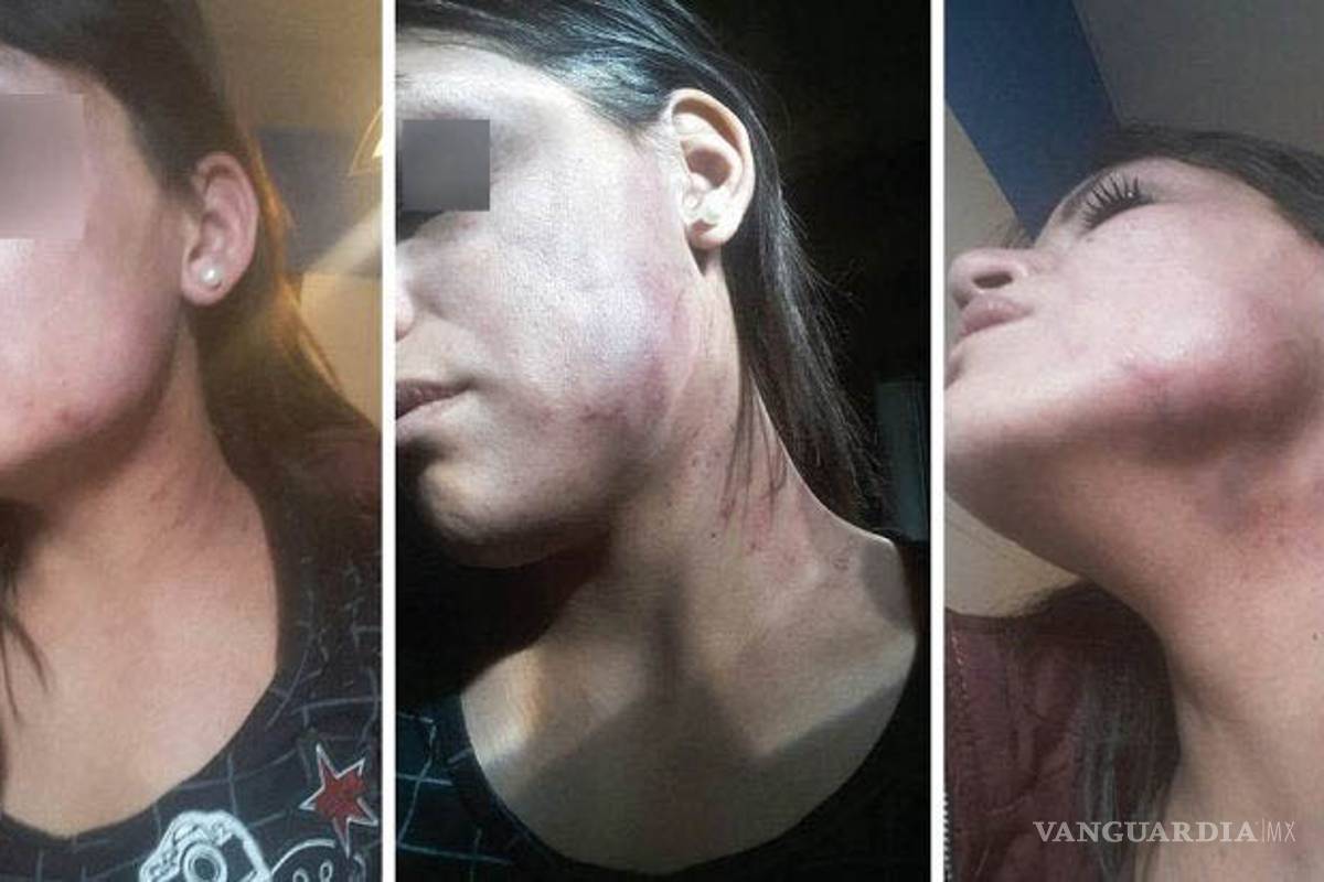 Por encierro por COVID-19 reinciden abusos sexuales contra la mujer