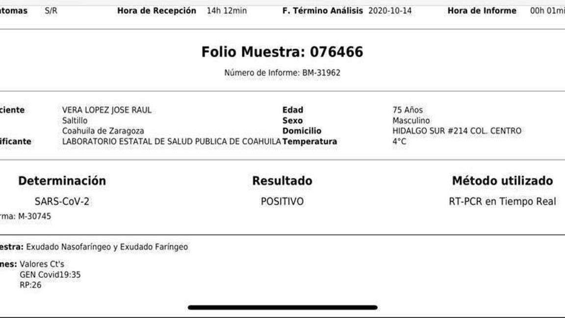 $!Obispo de Saltillo Raúl Vera López da positivo a COVID-19