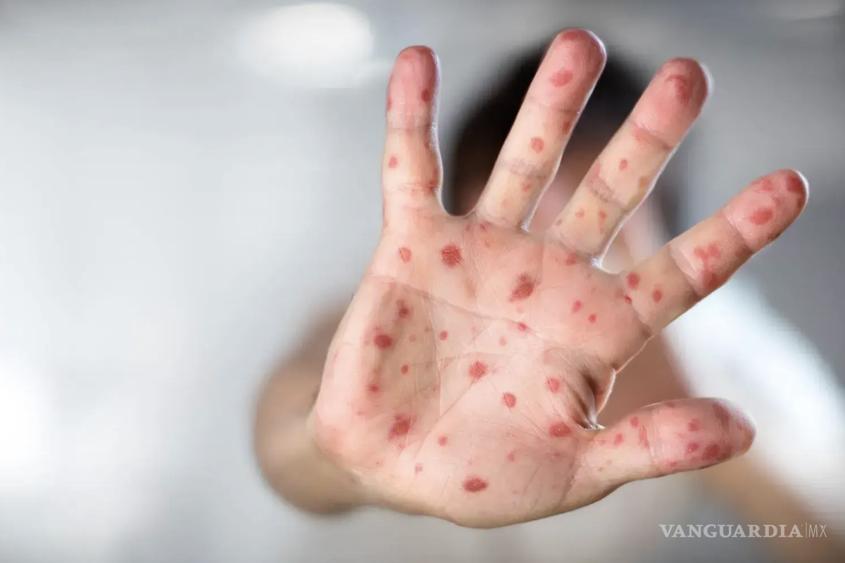 $!La mayoría de los estados reporta cifras controladas, siete entidades concentran los llamados “focos rojos”.