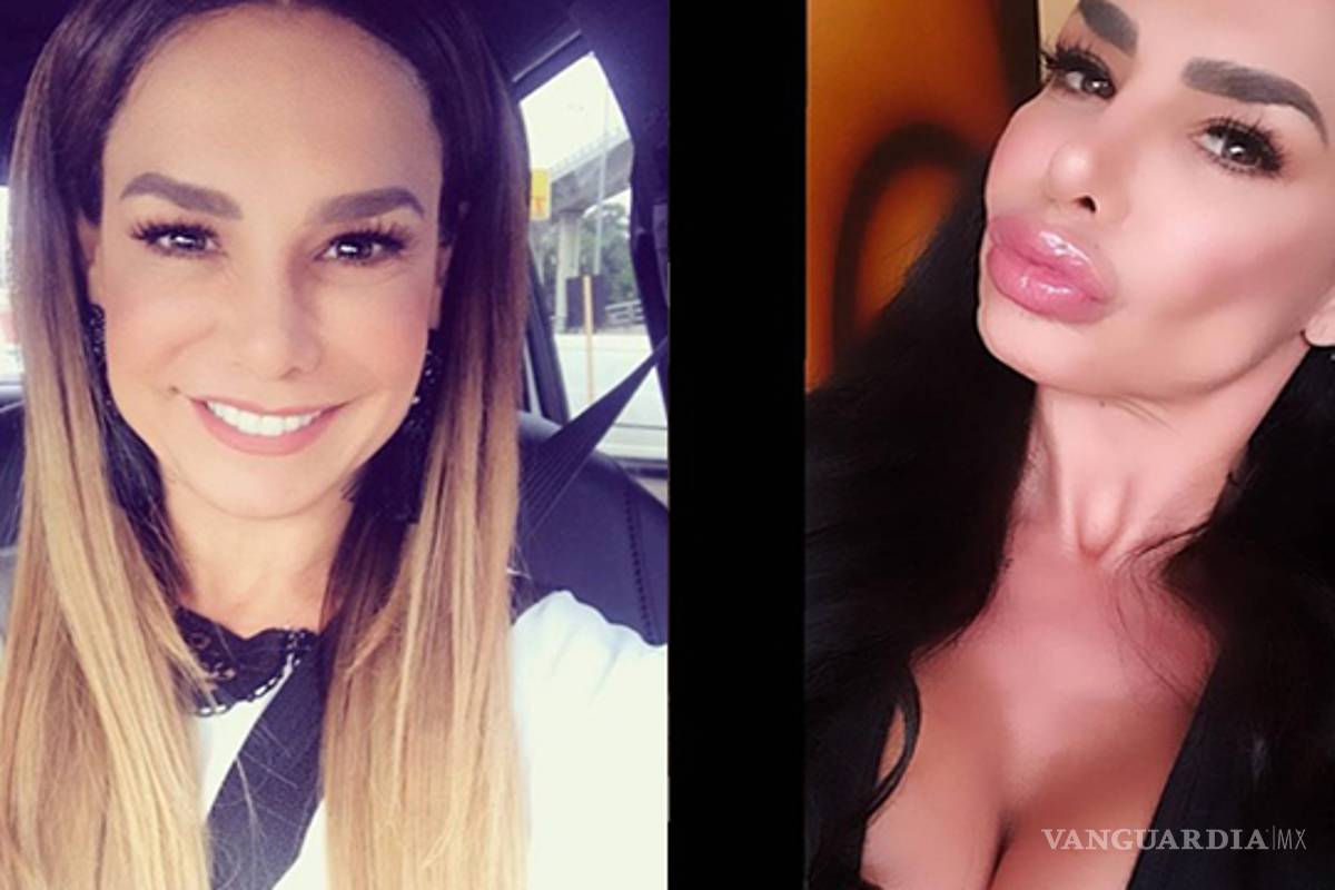 $!No solo es la Guzmán; estas celebridades quedaron peor con sus cirugías