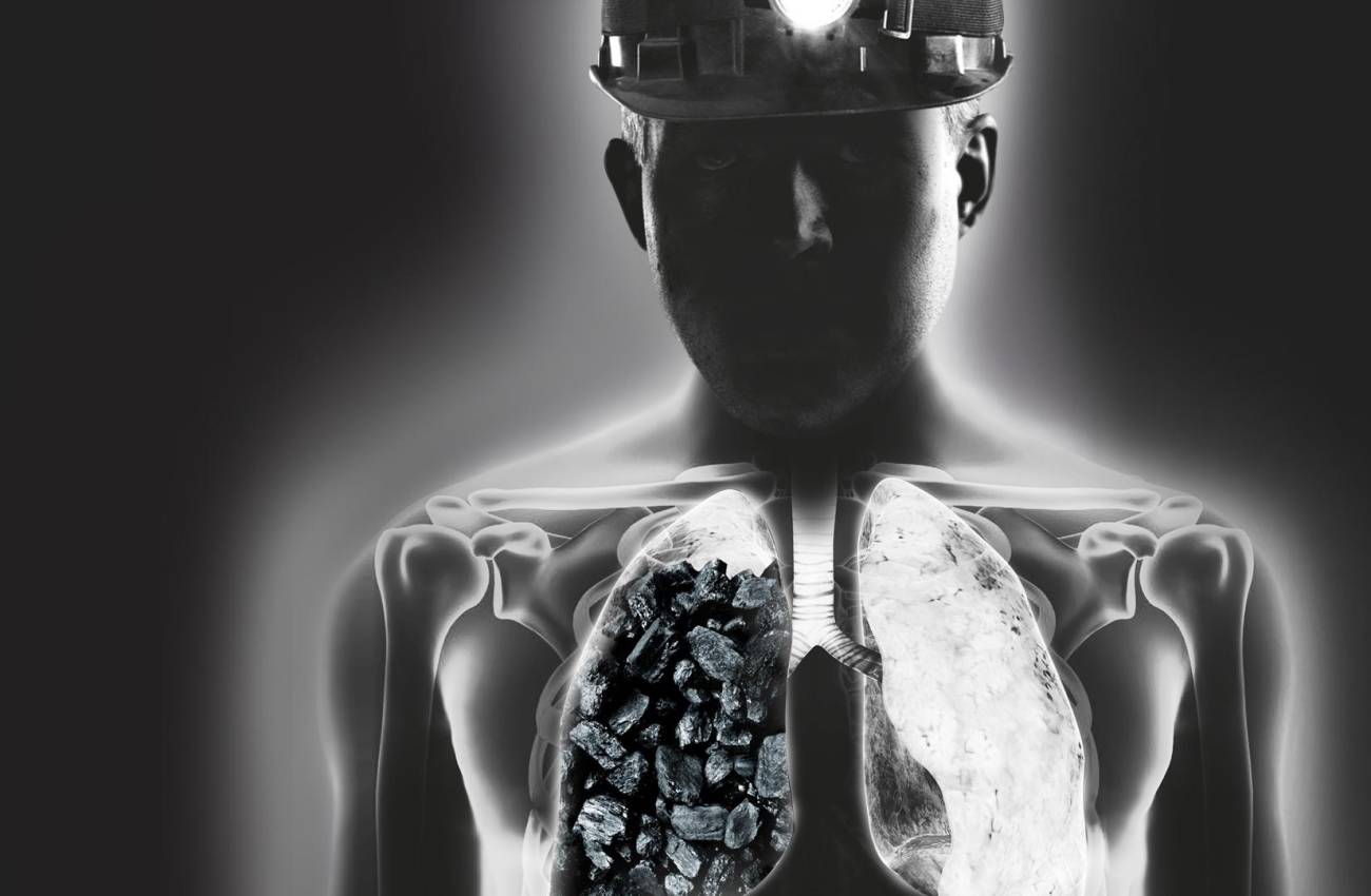 El viacrucis del minero de carbón: sin clínicas especializadas ni neumólogos
