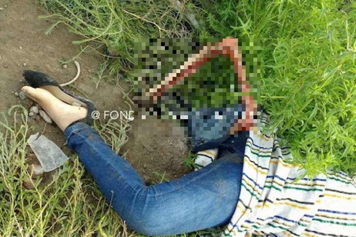 Joven es encontrada con el rostro desollado y sin una pierna (IMAGEN FUERTE)