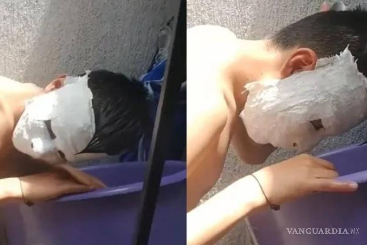 Estudiante queda atrapado en máscara de yeso y amenaza con demandar a su maestra
