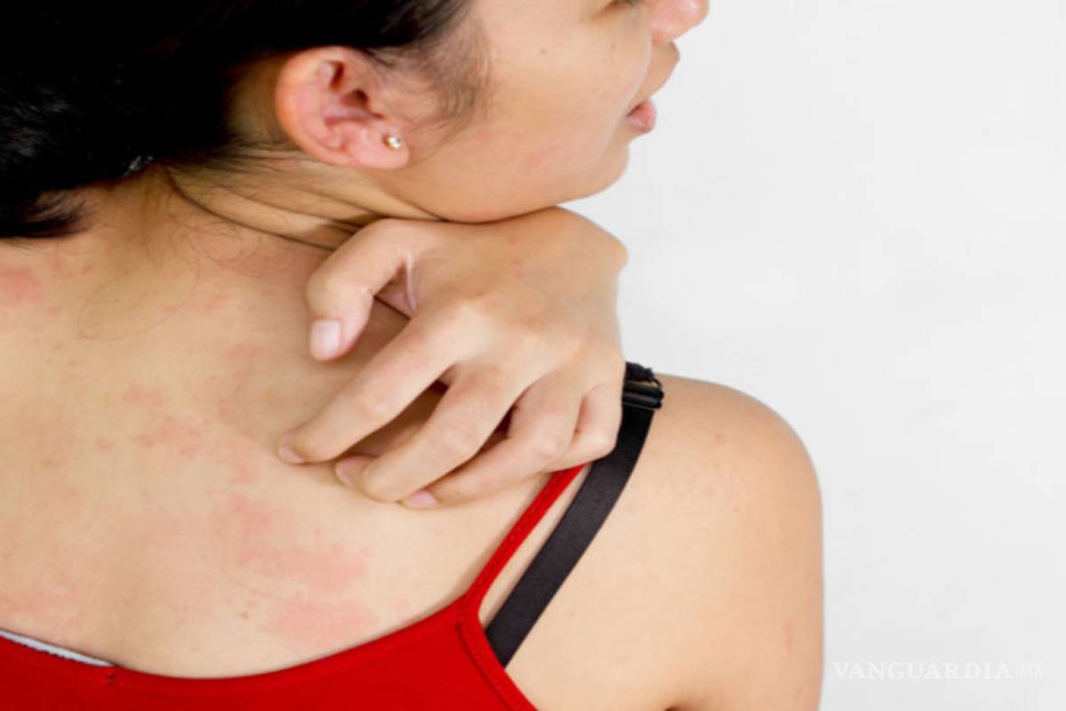 Confirman dos nuevos contagios en EU de zika por transmisión sexual