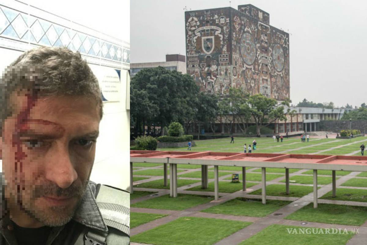 Pide disculpas Rector de la UNAM a periodista agredido en CU