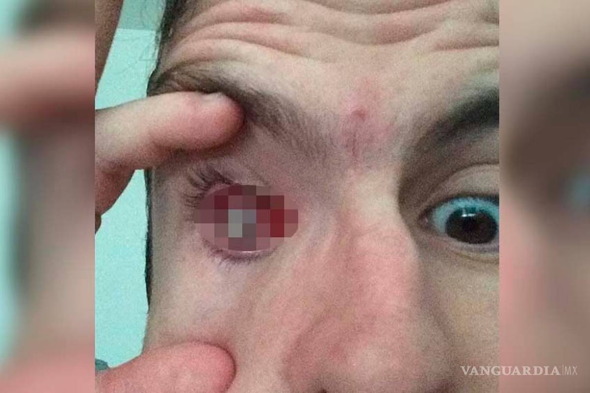 Futbolista británico pierde la vista por bañarse con lentes de contacto