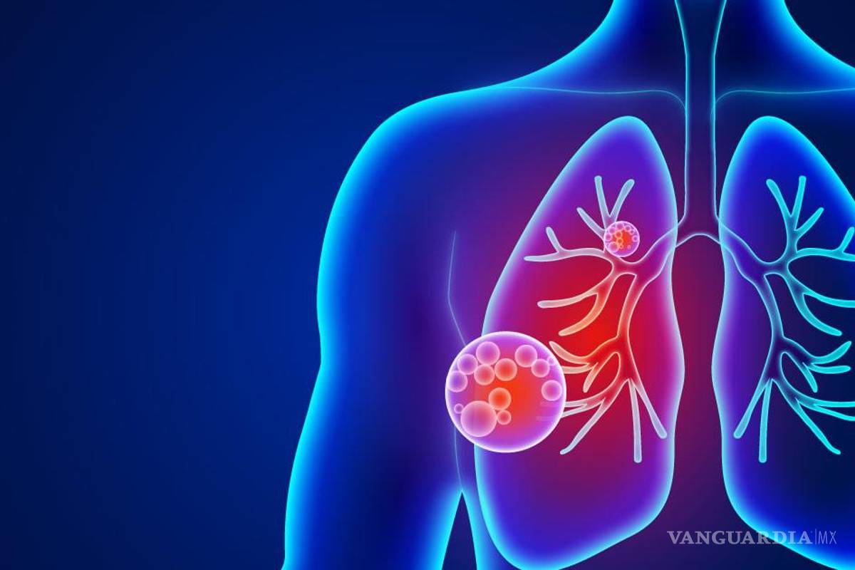 ¡Cuidado con la Neumonía!... prevención, síntomas y tratamiento en estas fechas invernales