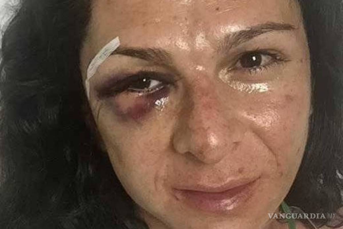 Testigos de agresión grabaron videos: Ana Guevara