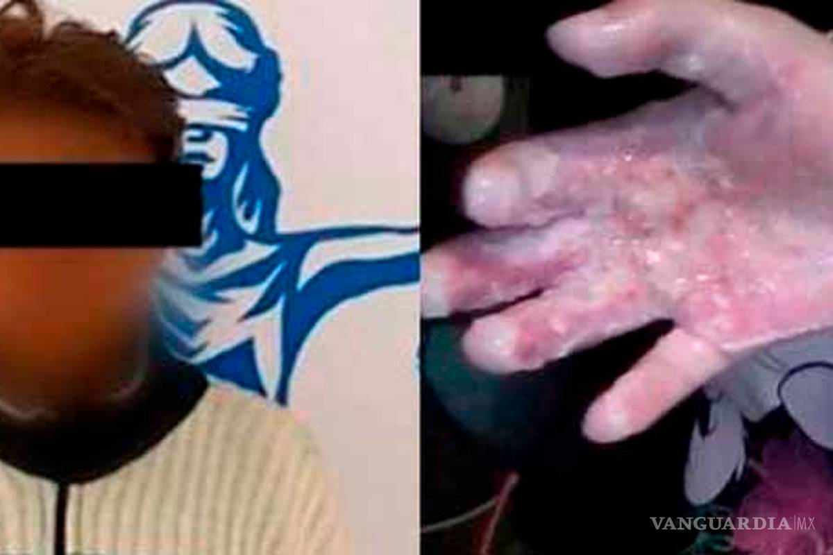 Vinculan a proceso a mujer saltillense que quemó las manos a su hija de cuatro años