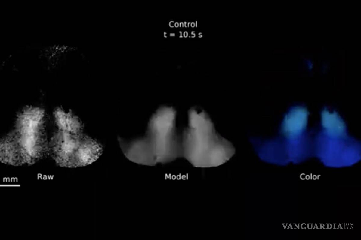 A través de un novedoso conjunto de herramientas es posible traducir a una neuroimagen del cerebro en un vídeo acompañado con música