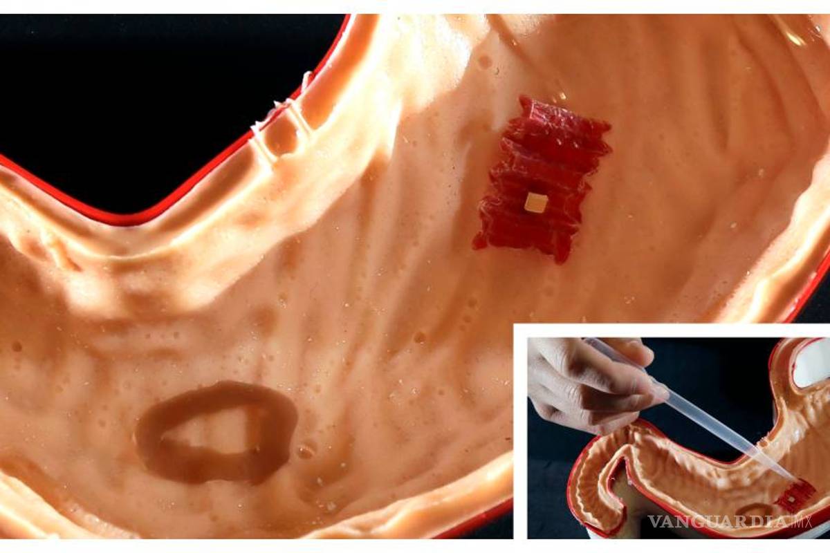 Crean un robot capaz de cerrar heridas o dar fármacos