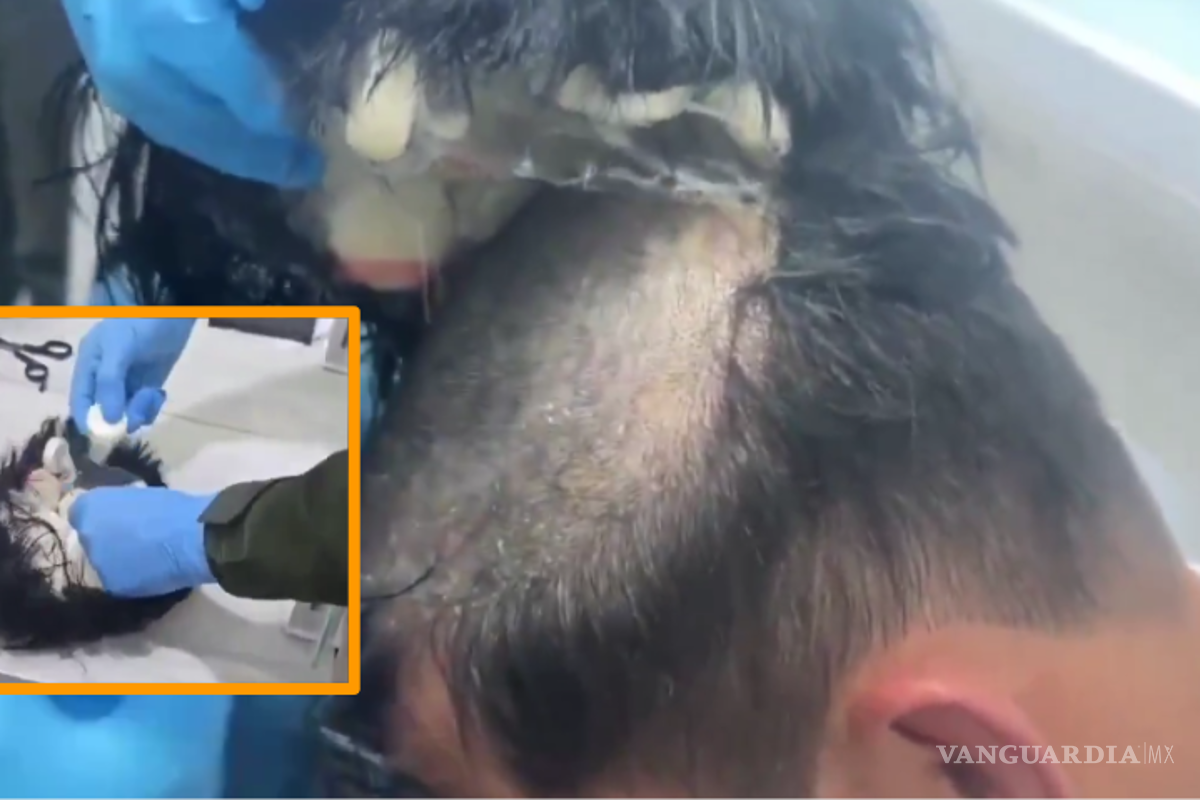 Colombia: Esconde droga en su peluquín y lo cachan en aeropuerto de Cartagena (VIDEO)