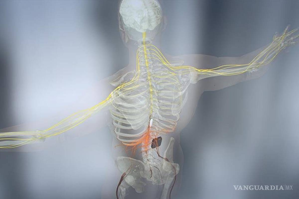 Una persona paralítica consigue caminar gracias a la estimulación eléctrica