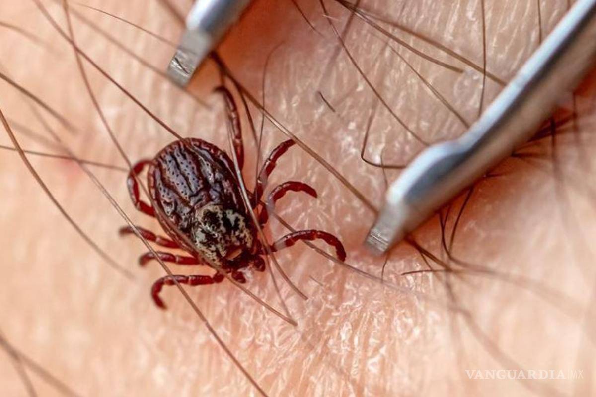 Niño de 4 años murió por Rickettsiosis en Torrreón, tras ser picado por una garrapata