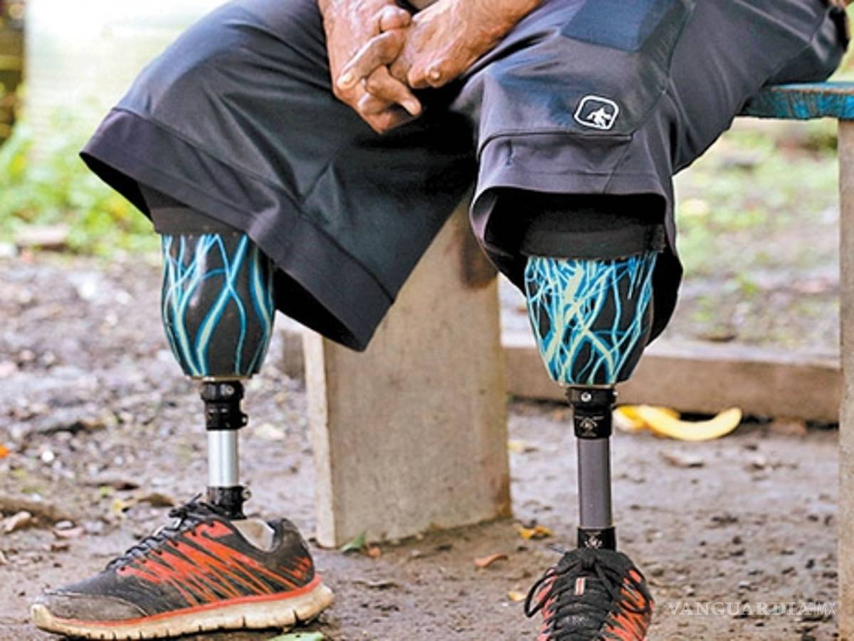 $!Quemados por el huachicol... los 19 mil heridos por el fuego en Puebla e Hidalgo