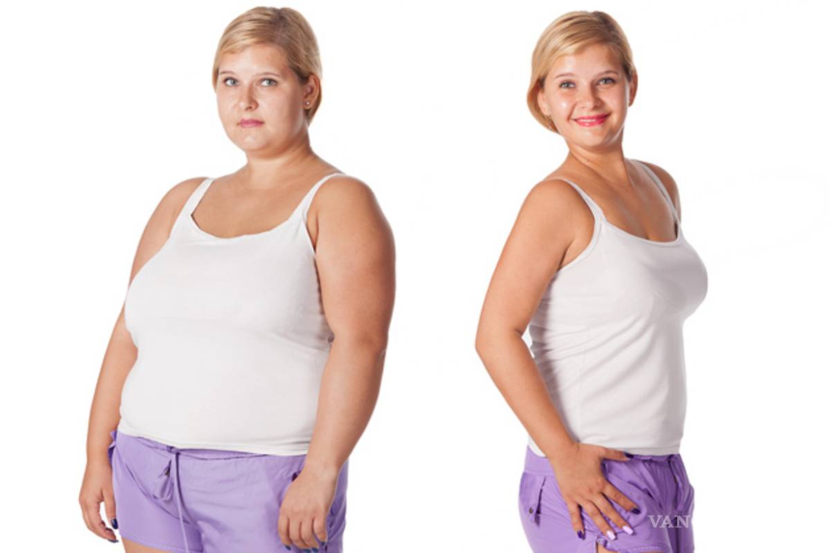 Cirugías contra la obesidad serán practicadas en el sector salud