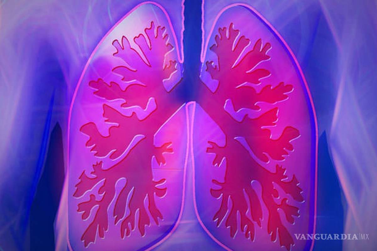 Fribosis pulmonar, una enfermedad con daños irreversibles