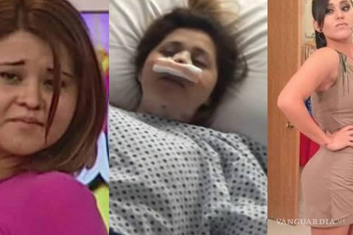 ‘Gomita’ muestra su adicción a las cirugías y revela sus cicatrices